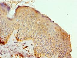 MRE11A / MRE11 Antibody (aa1-205)