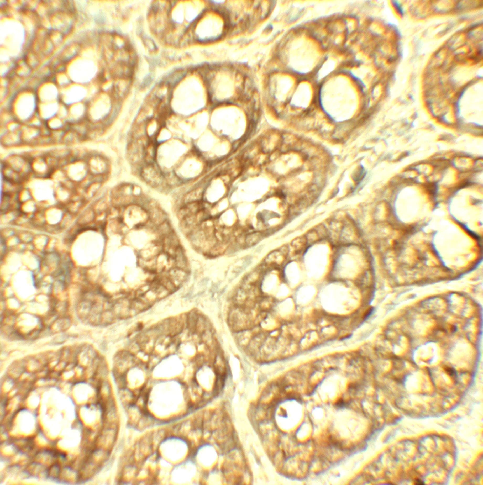 IHC-plus™ TRIP12 Antibody
