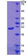 Human IL-1B / IL-1 Beta Protein (Recombinant His-T7)