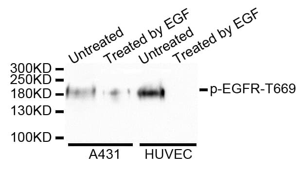EGFR Antibody (phospho-Thr693)