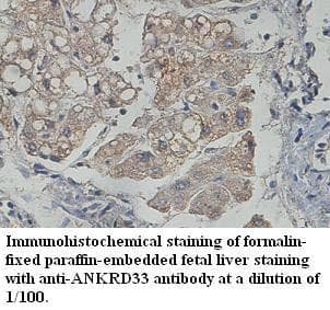 Polyclonal Rabbit anti-Human ANKRD33 Antibody (aa2-220, IHC, WB)