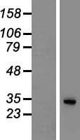 SGTB Protein (Over-Expression Lysate Myc-DDK (Flag))