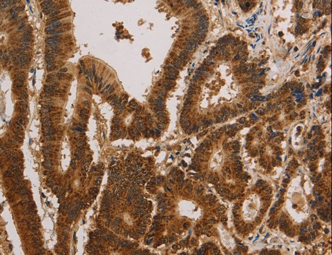 CSNK2B / Phosvitin Antibody