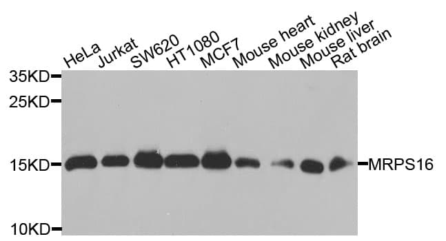 Polyclonal Rabbit anti-Human MRPS16 Antibody (WB)