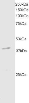 IHC-plus™ DAPK2 / DAP Kinase 2 Antibody (aa359-370)