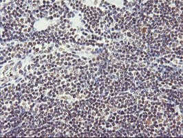 RNF113B Antibody (clone OTI1B10)