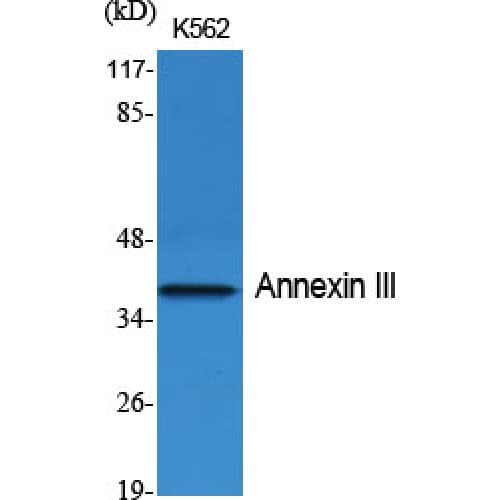 Polyclonal Rabbit anti-Human ANXA3 / Annexin A3 Antibody (Internal, IHC, WB)