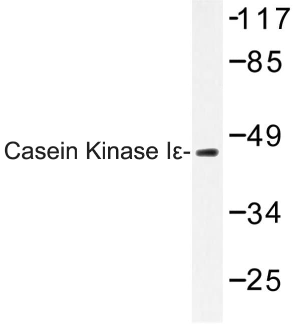 CSNK1E / CK1 Epsilon Antibody (Pro301)