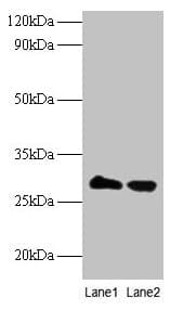 IHC-plus™ Polyclonal Rabbit anti-Human TPMT Antibody (IHC, WB)