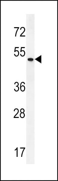 ZMYND17 Antibody (aa402-430)
