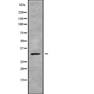 GJB5 / CX30.1 / Connexin 31.1 Antibody
