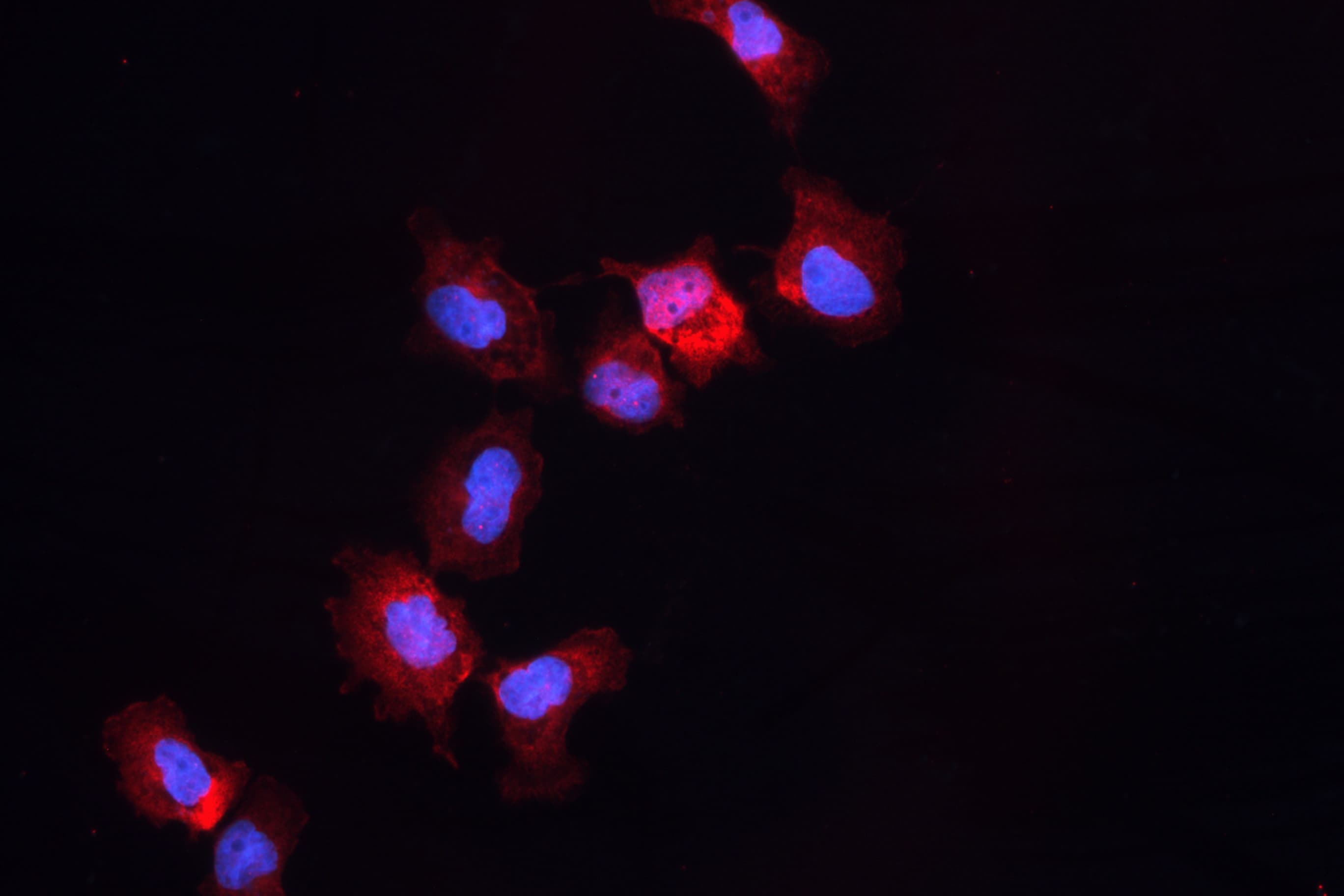 ALDH1A3 Antibody