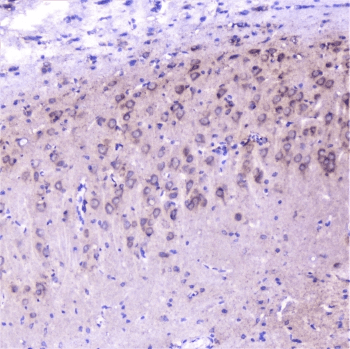 Polyclonal Rabbit anti-Human CTTN / Cortactin Antibody (IHC, IF, WB)