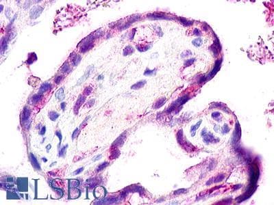 PathPlus™ ACKR2 / CCR10 / D6 Antibody (Internal)