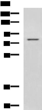 DHX58 / LGP2 Antibody