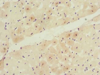 TCAP / Telethonin Antibody