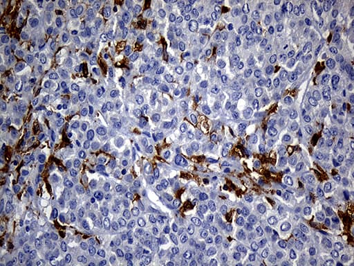 UBE3B Antibody (aa768-1068, clone OTI3F10, Carrier-free)