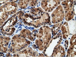 EPHX2 / Epoxide Hydrolase 2 Antibody (clone OTI1H5)