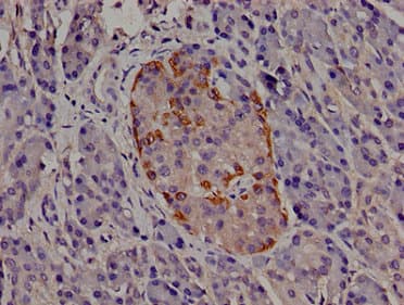 Polyclonal Rabbit anti-Human TRIP10 / CIP4 Antibody (IHC, IF)