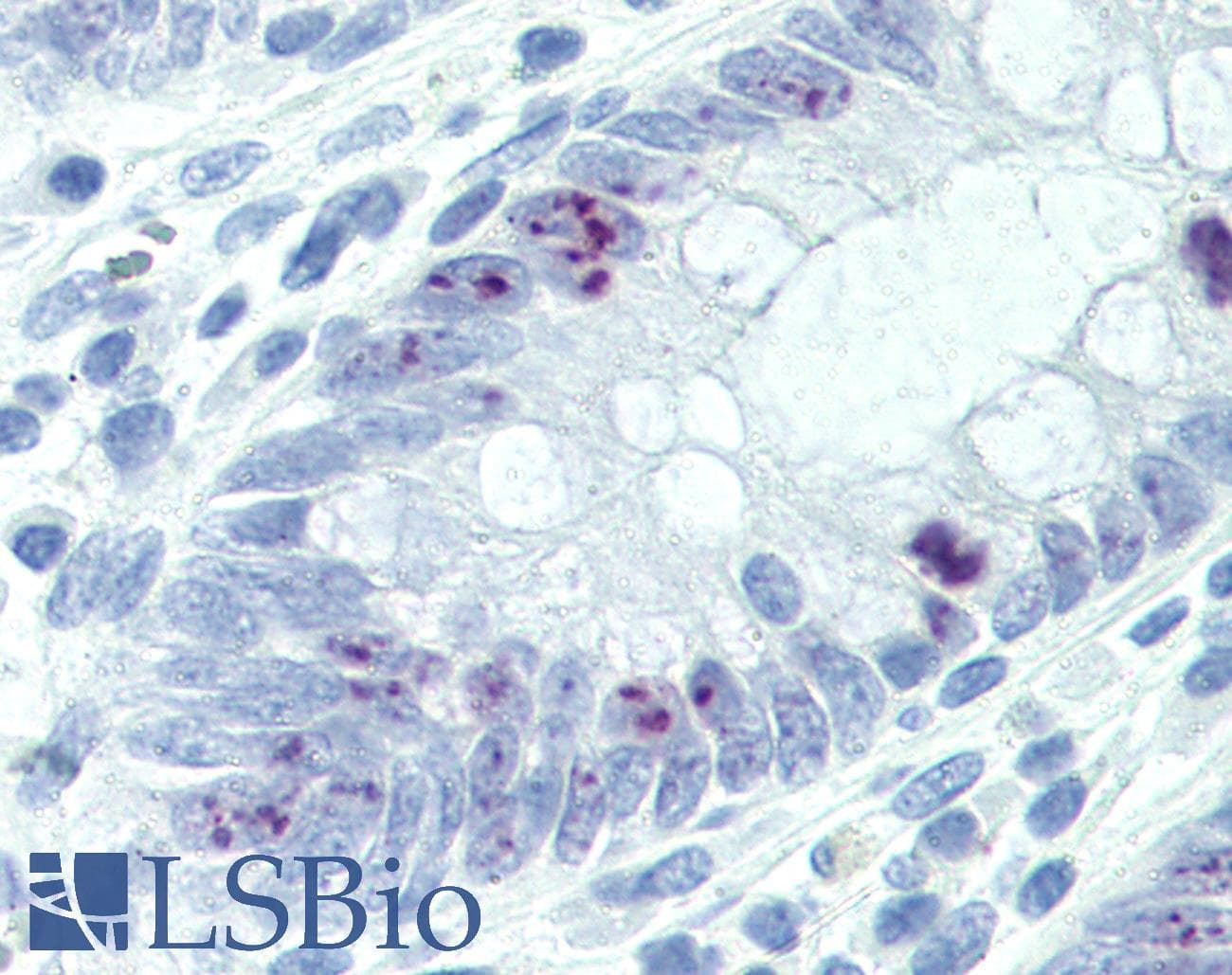 IHC-plus™ MKI67 / Ki67 Antibody (C-Terminus)