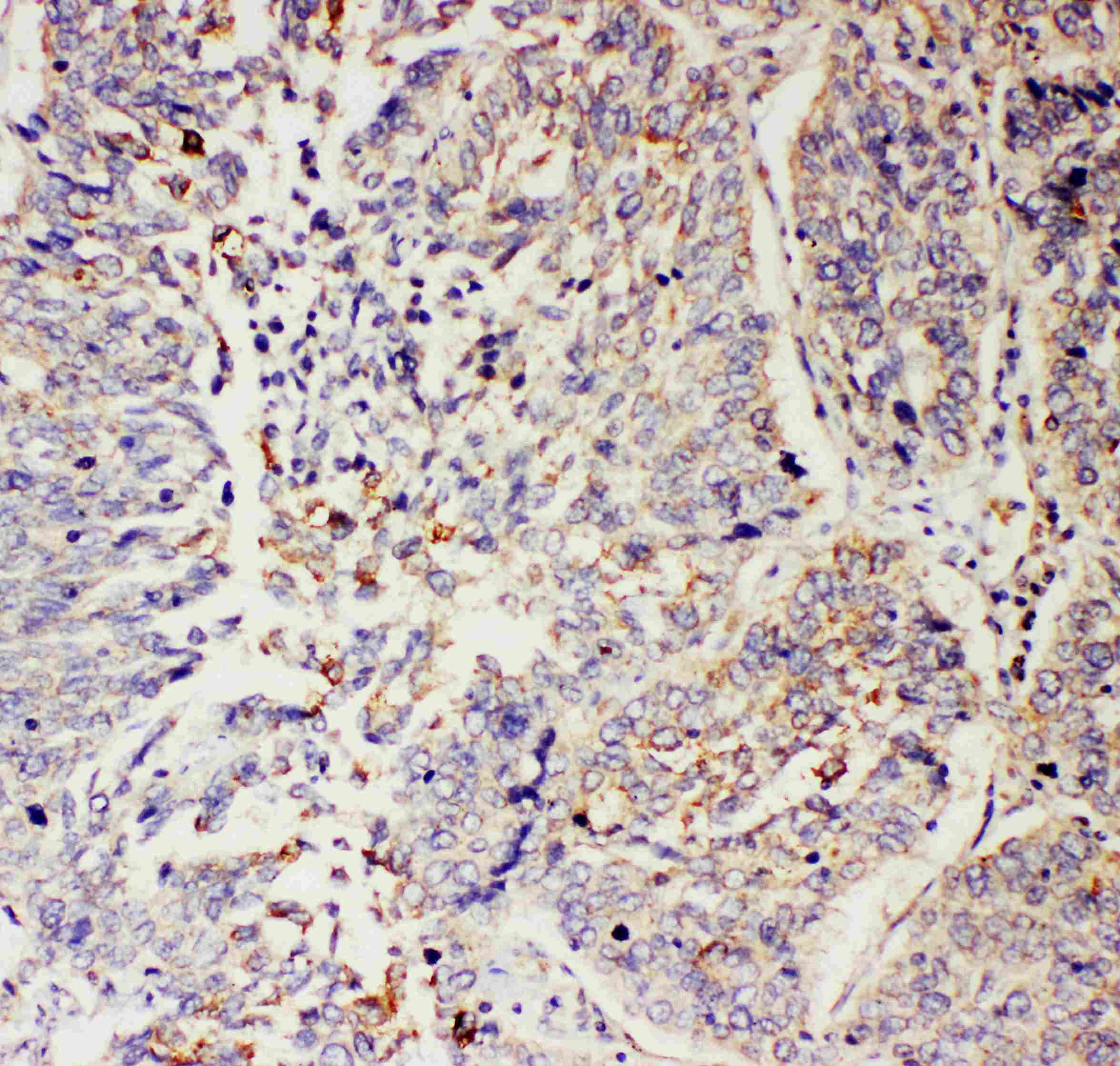 SLC9A2 / NHE2 Antibody (aa666-684)