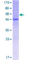 Human COMMD4 Protein (Recombinant GST)