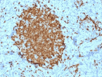 POU2AF1 / BOB1 Antibody (clone BOB1/2421)