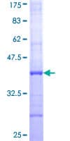 Human PC / Pyruvate Carboxylase Protein (Recombinant GST, N-terminus)