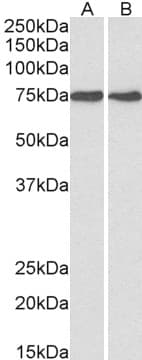 IHC-plus™ HSPA5 / GRP78 / BiP Antibody