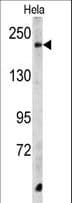 Polyclonal Rabbit anti-Human CPD Antibody (aa1019-1048, WB)