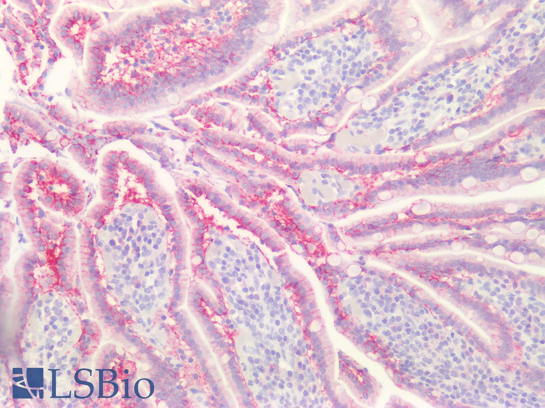 PathPlus™ CLDN4 / Claudin 4 Antibody (aa160-209)