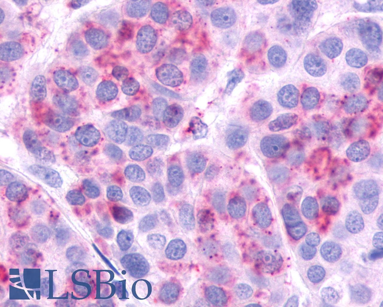 Polyclonal Rabbit anti-Human AVPR2 / V2R Antibody (Cytoplasmic Domain, IHC)