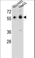 TRIM64 Antibody (aa346-374)