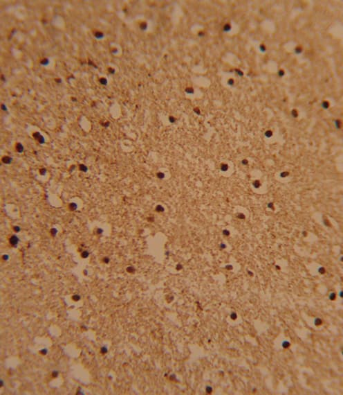 PSMB1 Antibody (aa214-241)