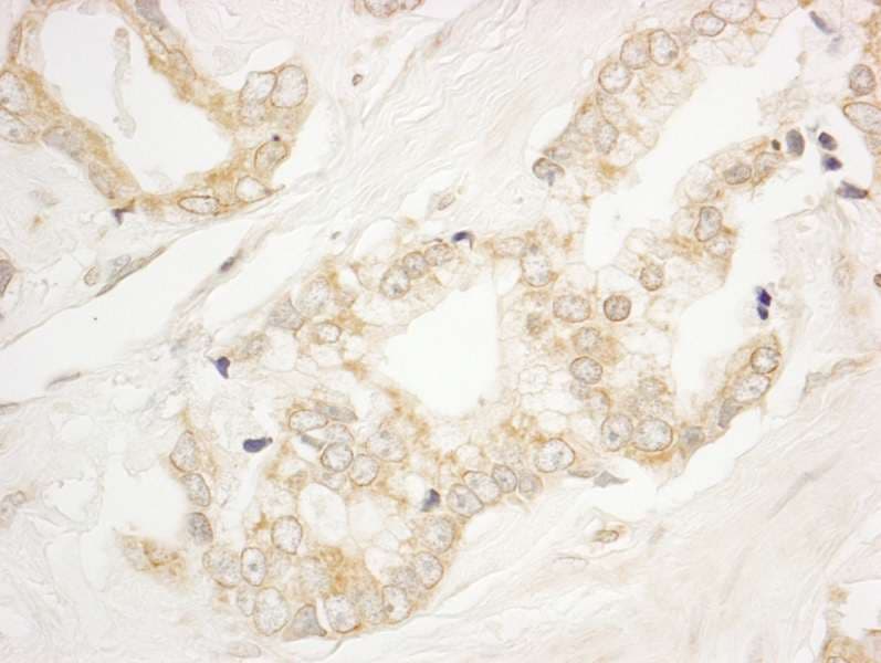 Polyclonal Rabbit anti-Human ARFGEF1 Antibody (aa1800-C-term, IHC, WB)
