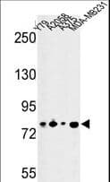 CSRP2BP Antibody (aa246-275)