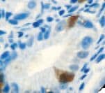Gastrin Antibody