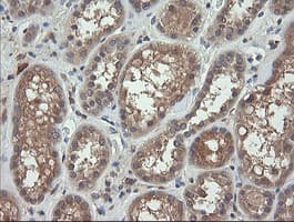 TCL / RHOJ Antibody (clone OTI2C9)