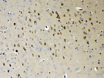 NDRG3 Antibody