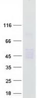 Human Carboxypeptidase O / CPO Protein (Recombinant Myc-DDK (Flag))