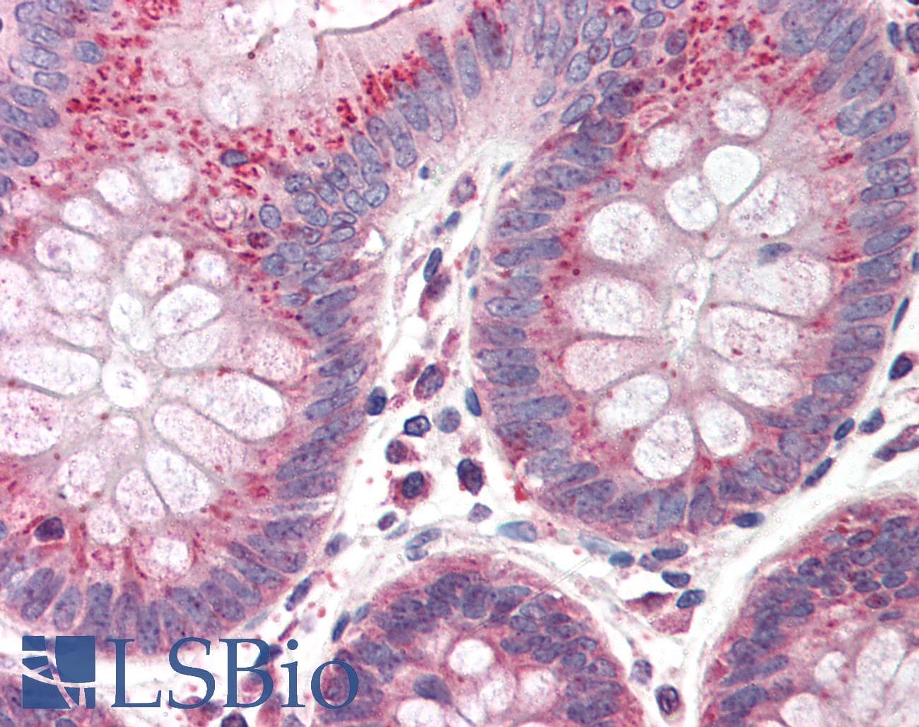 IHC-plus™ CUL9 / Cullin 9 Antibody (aa2503-2517)