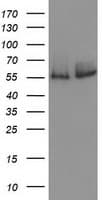 CAT / Catalase Antibody (clone OTI3C3)
