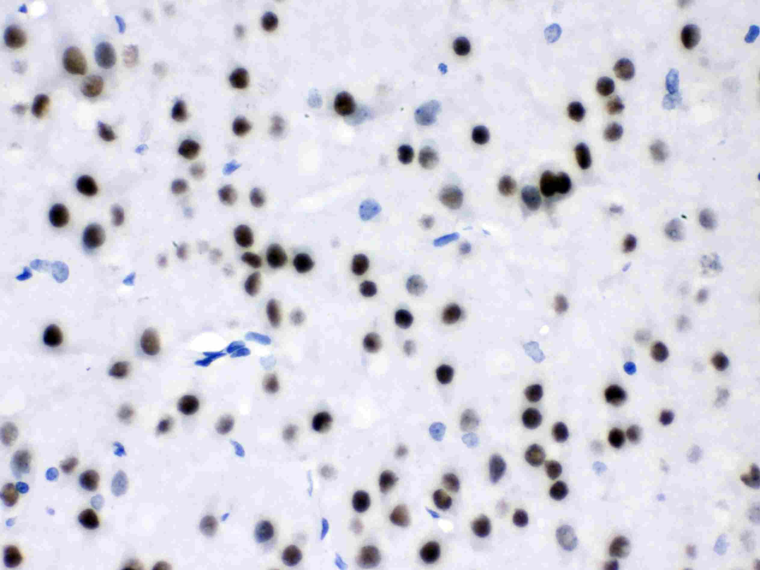 MEF2A / MEF2 Antibody