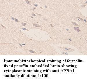 Polyclonal Rabbit anti-Human APBA1 / MINT1 Antibody (Internal, IHC)