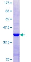 Human IFIH1 / MDA5 Protein (Recombinant GST, N-terminus)