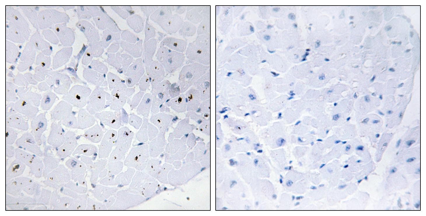 CCNE1 / Cyclin E1 Antibody