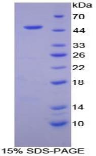 Human PGES / PTGES Protein (Recombinant His-GST)