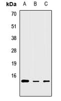 Polyclonal Rabbit anti-Human MRPS6 / MRP S6 Antibody (WB)