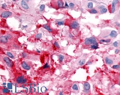 PathPlus™ ADGRD1 / GPR133 Antibody (N-Terminus)