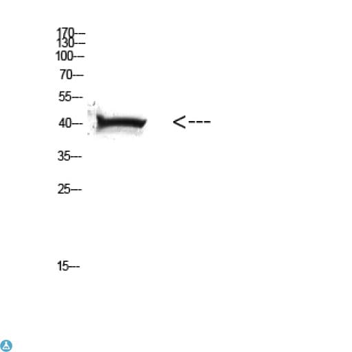 Polyclonal Rabbit anti-Human Anti-HLA Class I antibody Antibody (WB)